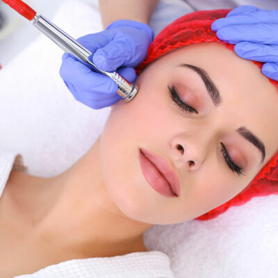 Scar Removal – Common Methods and Cost