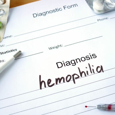 Hemophilia – Symptoms, Types, and Management Options