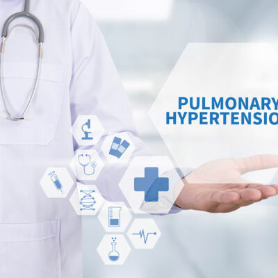 Pulmonary arterial hypertension – Causes, symptoms, and preventive measures