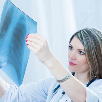 Pneumonia – Causes, signs and treatments