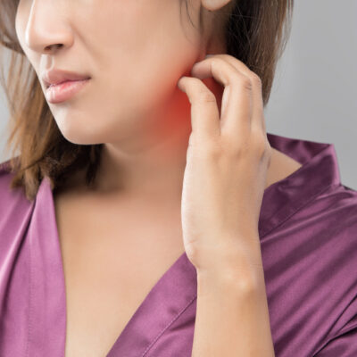 Shingles – Understanding The Condition